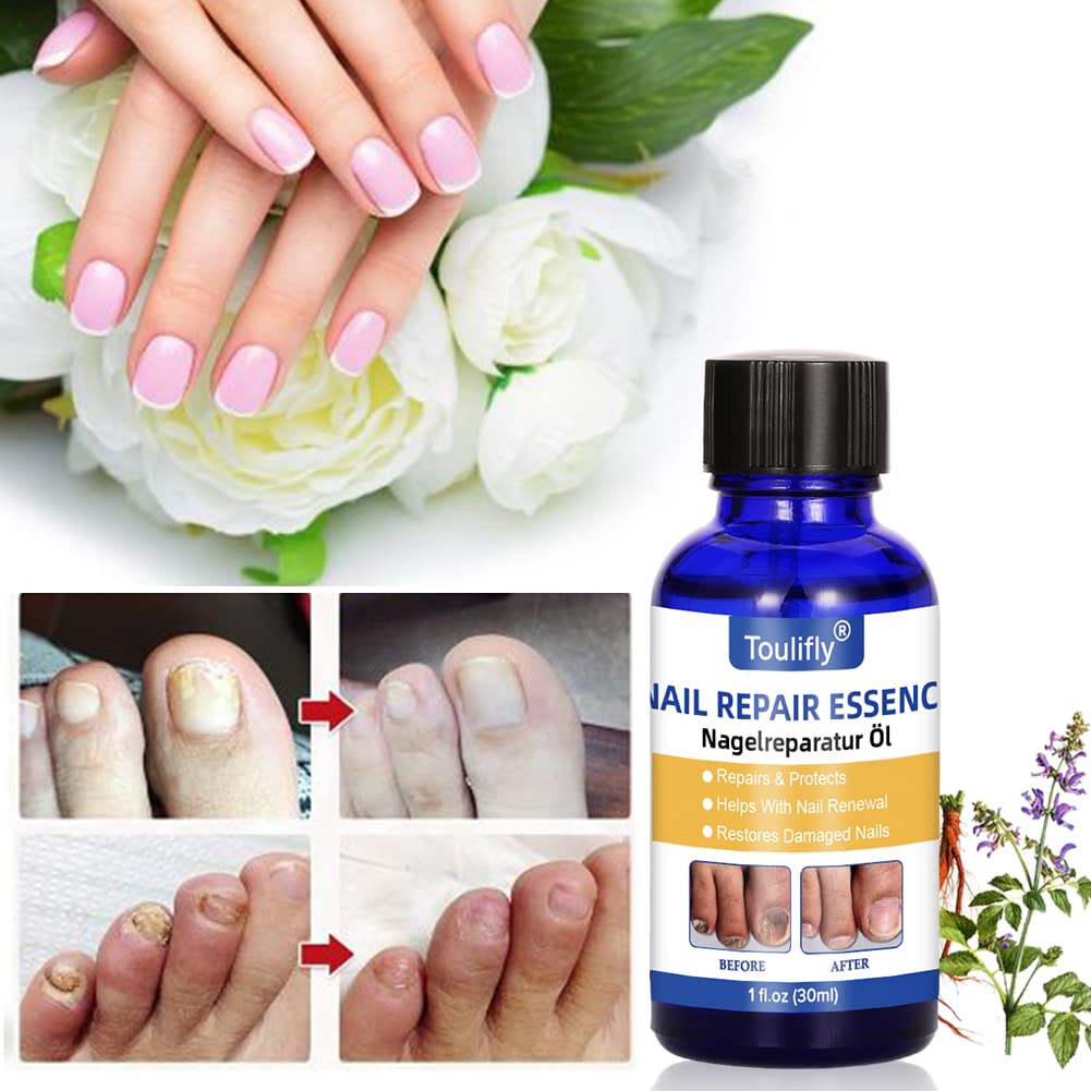 Nagelpflege und Behandlung, Nagelpflege für gesunde Fuss und Hand, Nagelpflegeöl,Nagelpflege pflegen