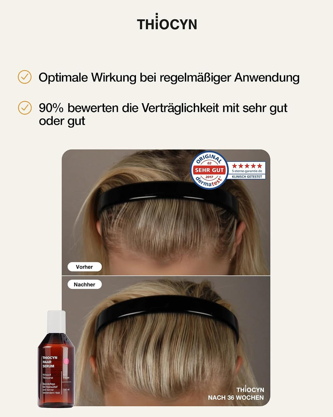 Thiocyn Haarserum gegen Haarausfall Frau 3 x 150 ml - Haarwachsstum beschleunigen mit Thiocyanat, Bi
