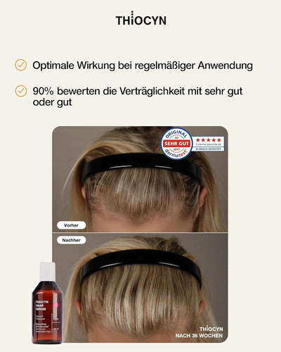 Thiocyn Haarserum gegen Haarausfall Frau 150 ml - Haarwachsstum beschleunigen mit Thiocyanat, Biotin