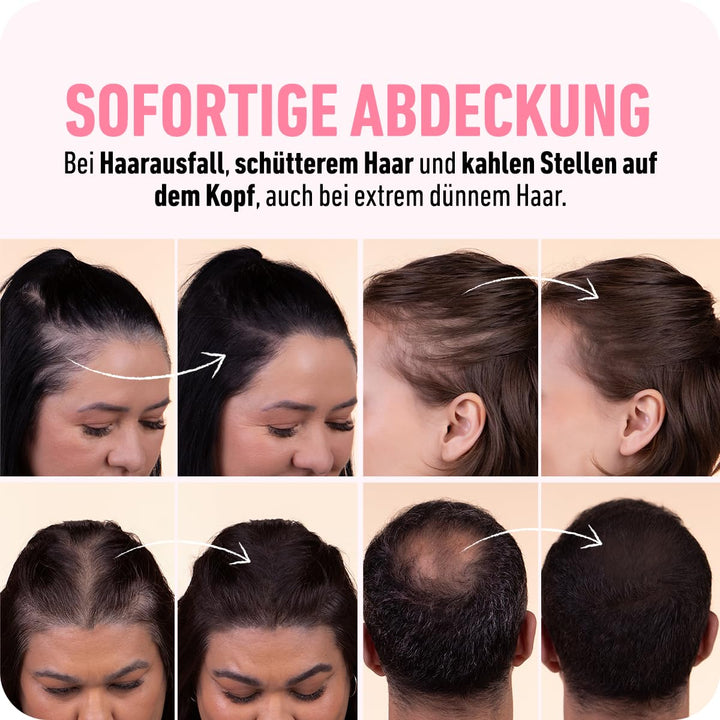BOLDIFY Ansatzpuder 4g - Haar Concealer zur Haarverdichtung für Frauen und Männer, Grauabdeckung für
