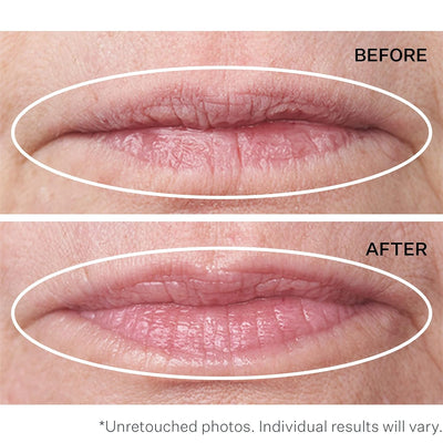 StriVectinDouble Fix For Lips 5+5 Ml, black
