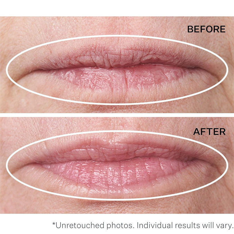 StriVectinDouble Fix For Lips 5+5 Ml, black