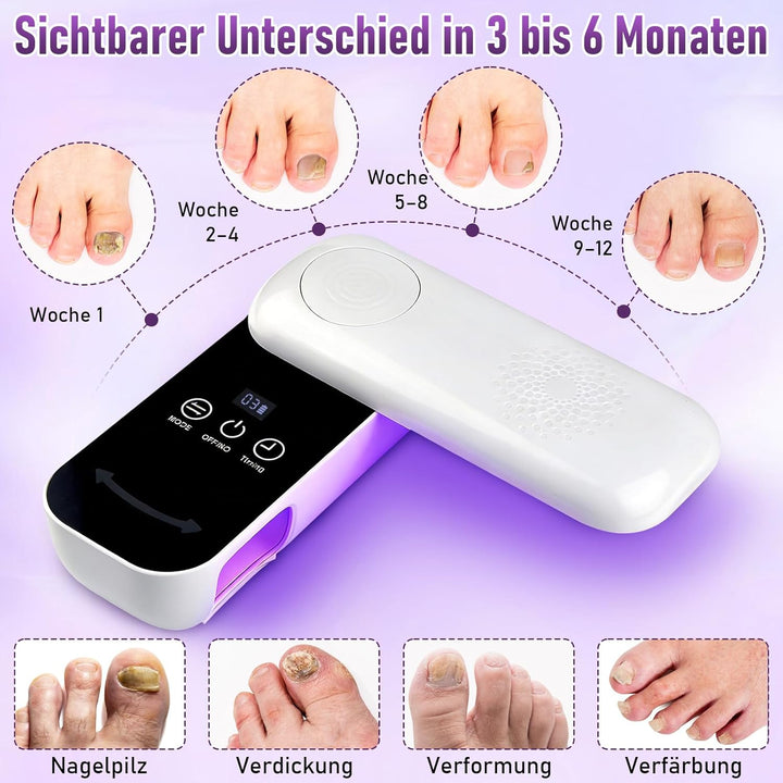 Nagelpilz Lasergerät, UV Lampe für Gelnägel, UV LED Nagellampe mit 36 Perlen 4 Lichtquellen 3 Timer