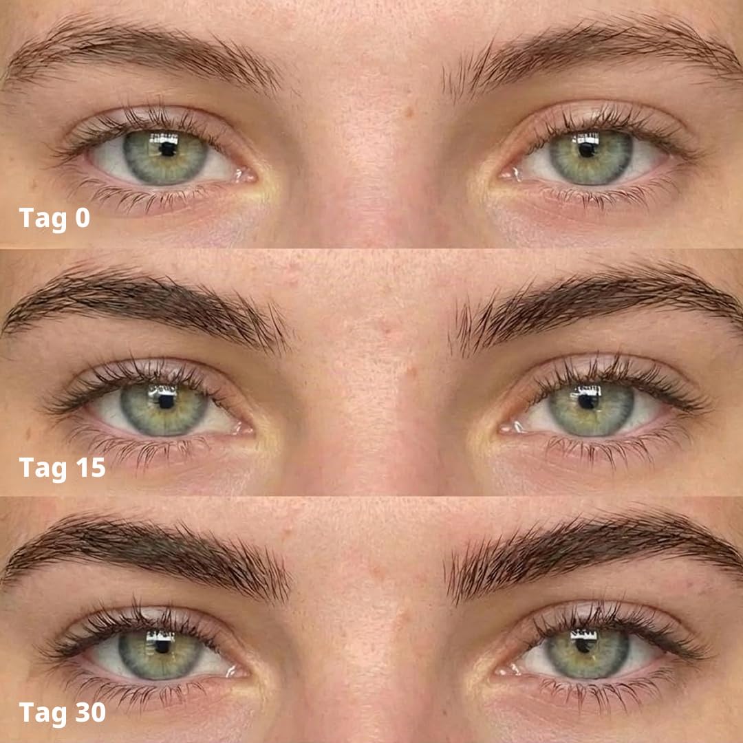 ForChics ForBrow Augenbrauenwachstumsserum für dickere Augenbrauen, natürlicher und organischer Cond