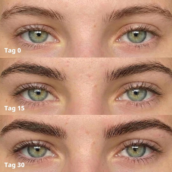 ForChics ForBrow Augenbrauenwachstumsserum für dickere Augenbrauen, natürlicher und organischer Cond