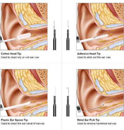 SANON Ohrenschmalz Entferner Otoskop, Otoskop Ohrreiniger, Ohrenschmalz Entferner HD Kamera mit 6 Di