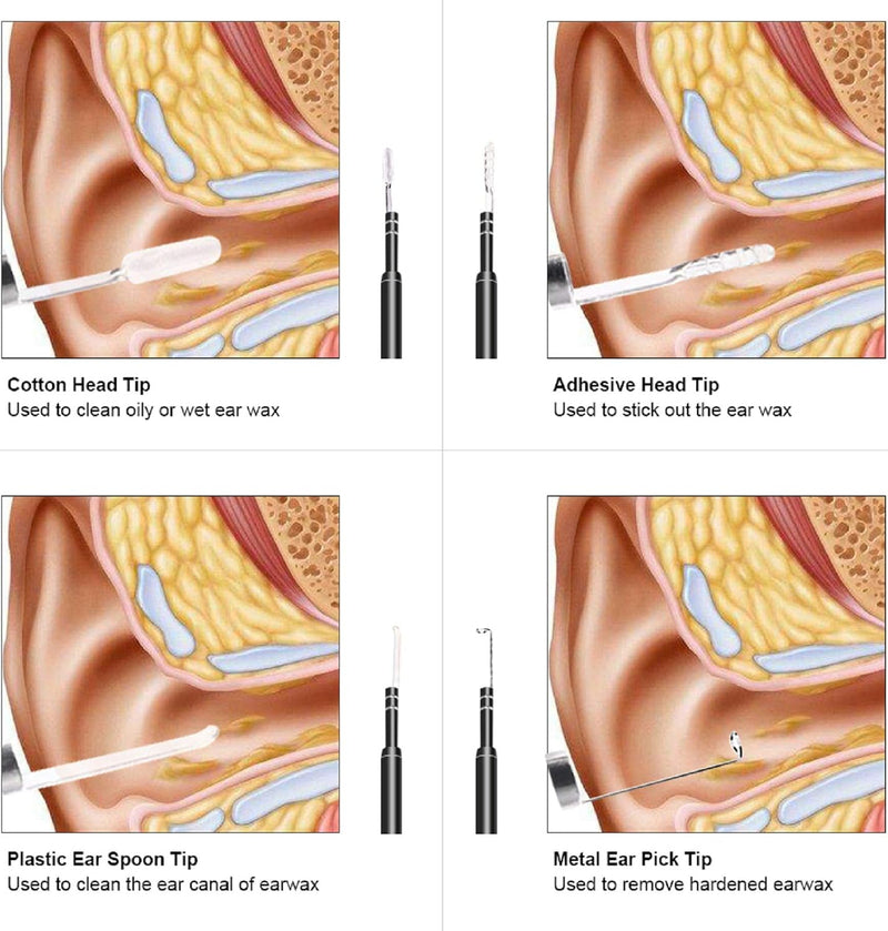 SANON Ohrenschmalz Entferner Otoskop, Otoskop Ohrreiniger, Ohrenschmalz Entferner HD Kamera mit 6 Di