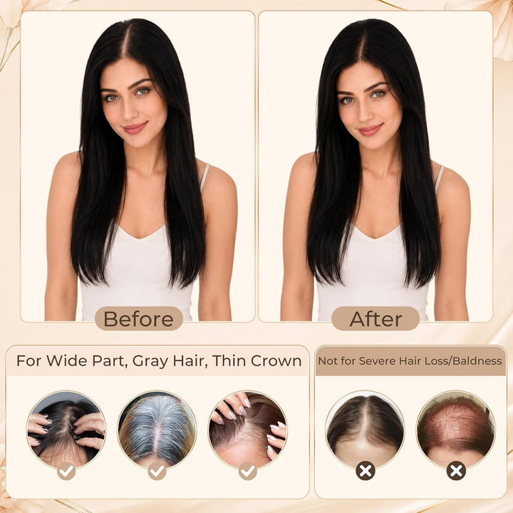 S-noilite Toupet für Damen, Clip in Haar Toppers mit Seitenpony 100% Echthaar für Dünnes Haar Oberko
