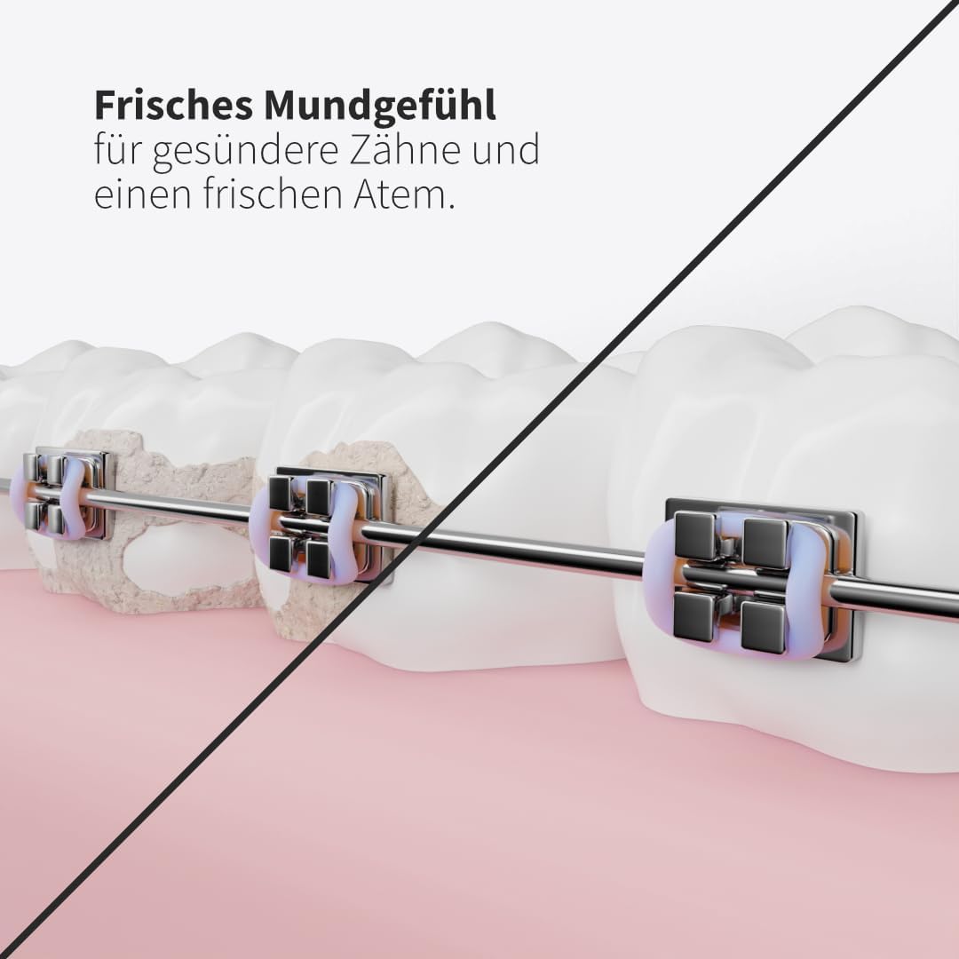 Zahnheld® Ersatzdüsen Basic für Munddusche Aquadent (6 Stück, weiss) 6 Stück Weiss, 6 Stück Weiss