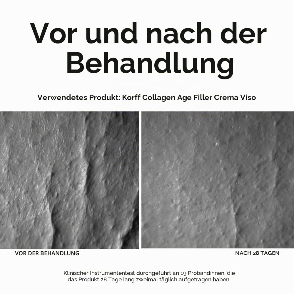 Korff Collagen Age Filler Gesichtscreme Globale Anti-Age Formel mit Age Filler Complex, Meereskollag