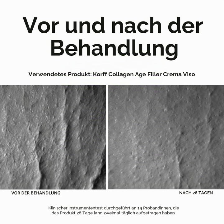 Korff Collagen Age Filler Gesichtscreme Globale Anti-Age Formel mit Age Filler Complex, Meereskollag