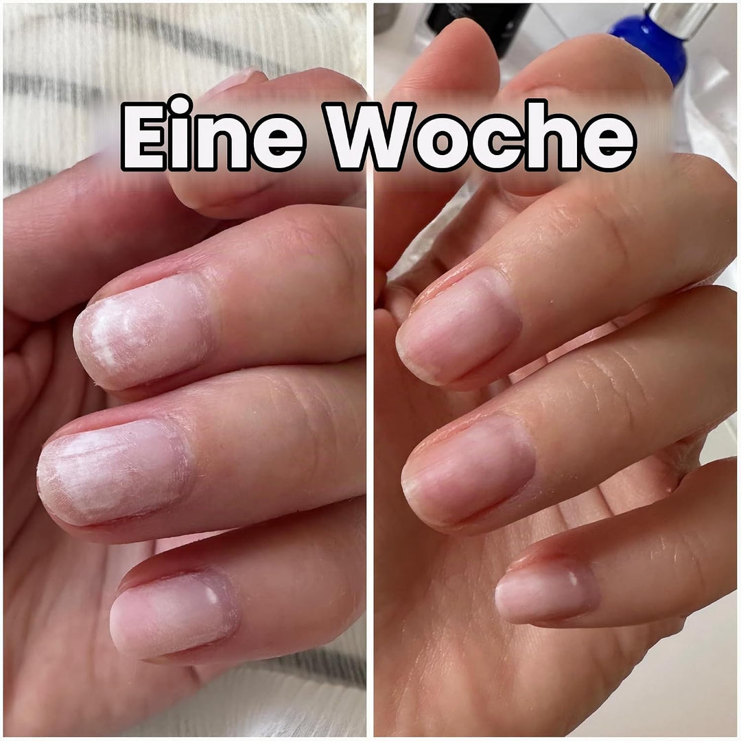 Elegans Nagelserum zur Stärkung &amp; Regeneration – Nagelpflege für brüchige &amp; strapazierte Nägel – ide