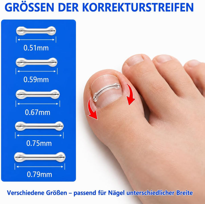 Eingewachsene Zehennägel Set, Universal Nagelspange Fussnägel Korrektu | Fünf Verschiedene Grössen,