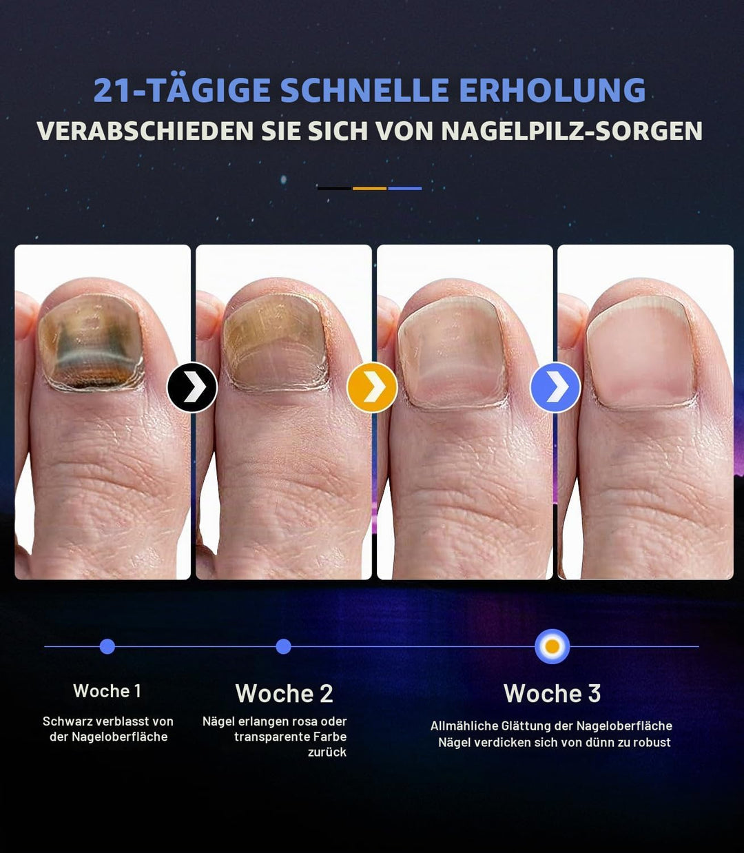2025 Upgrade Nagelpil Lasergerä【Verwendung für Mehrere Fingernägel und Zehennägel - 3/5/7/10min】Nage