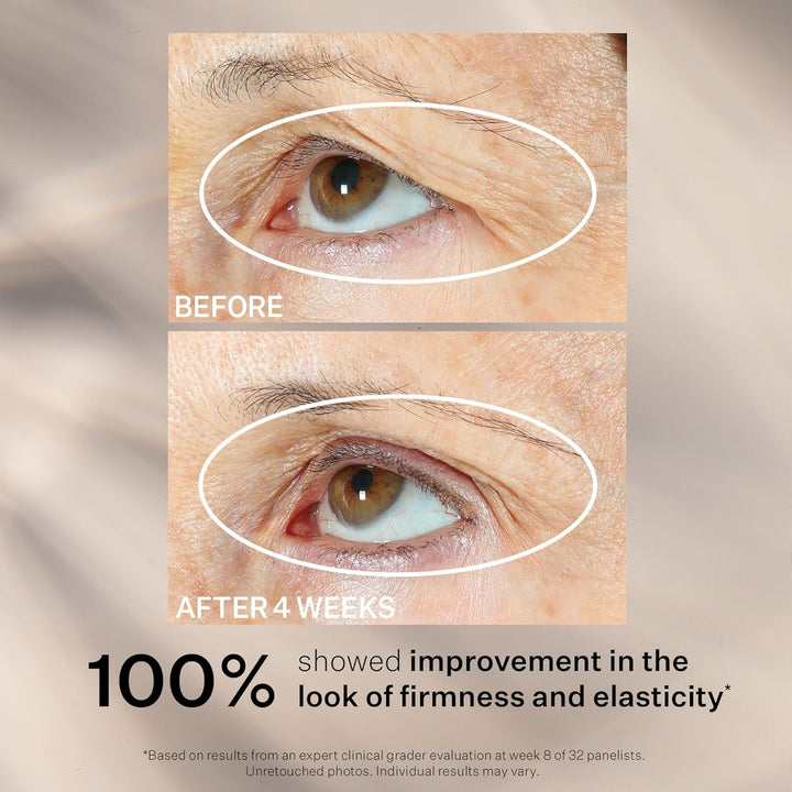 StriVectinTIGHTEN & LIFT 360º tightening eye serum 30 ml, Tighten & Lift