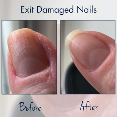 Herome Combi-Pack Ende Extrem Beschädigte Nägel Nagelpflege Nagelöl & Nagelhärter Extra Stark (Exit
