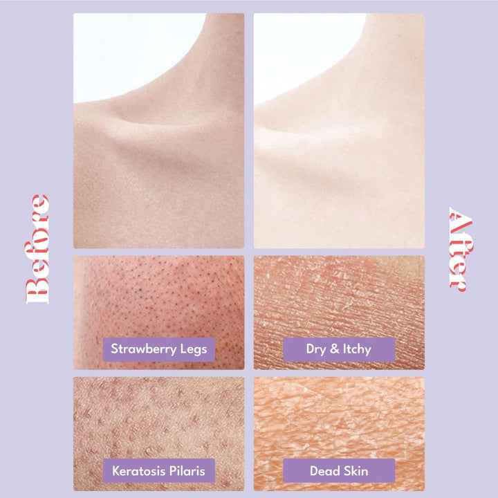 TOI:L Gentle Touch Bubble Peeling-Körperpad, Körperpeeling, Peelinghandschuh für den Körper, Peeling