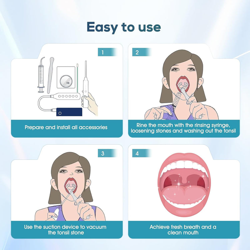 Tonsillenstein Entferner Set, Elektrisches Mandelsteine Entfernen, 3-Gang-Saug-Munddusche, Mit LED-L