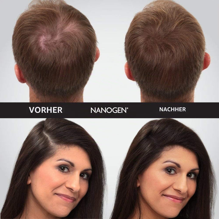 Nanogen Hair Thickening Fibres Dark Brown, 30g dunkelbraun 30g, dunkelbraun 30g