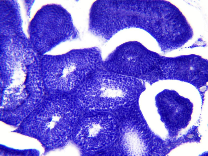 Bresser Mikroskop Dauerpräparate 30 Stück in Kunststoffbox, Lernpräparate aus der Biologie Single, S