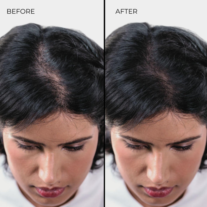 Nanogen Hair Thickening Fibres Black 30g schwarz 30g, schwarz 30g