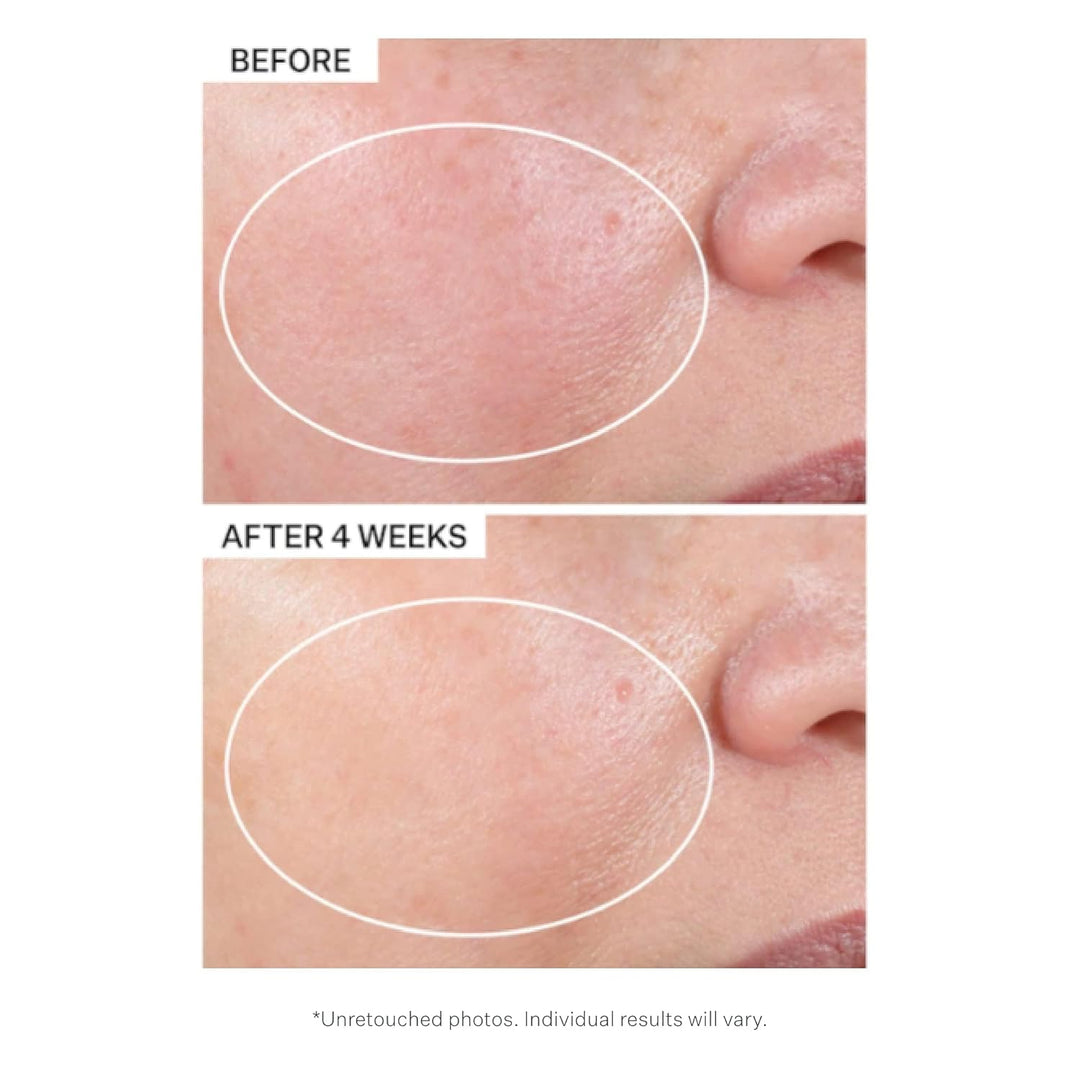 Advanced Retinol Intensive Night Moisturizer 50 Ml Einzelbett, Einzelbett
