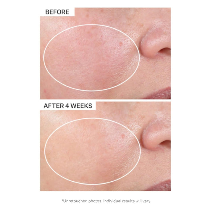 Advanced Retinol Intensive Night Moisturizer 50 Ml Einzelbett, Einzelbett