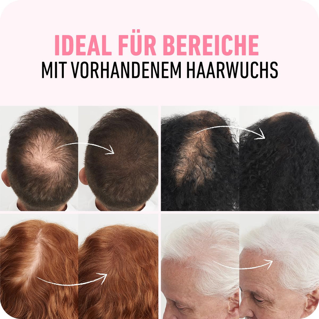 BOLDIFY Streuhaar für Dünner Werdendes Haar (Aschbraun), Unsichtbar, Natürlich, Grosse Flasche, 28g,