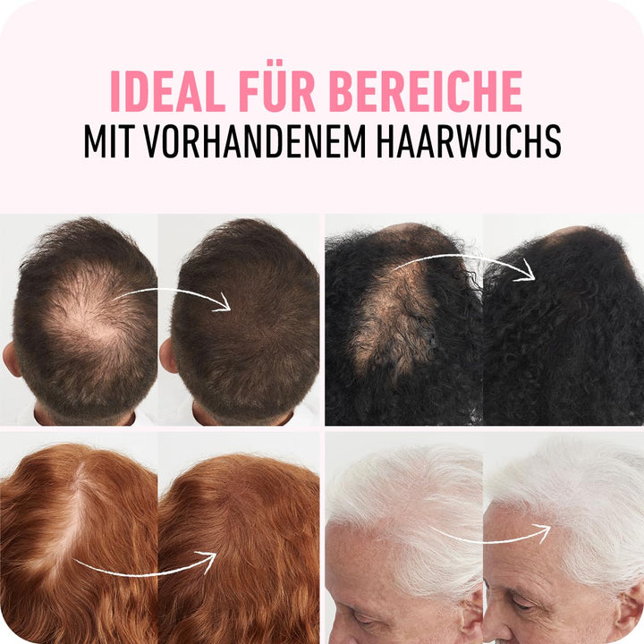 BOLDIFY Streuhaar für Dünner Werdendes Haar (Aschbraun), Unsichtbar, Natürlich, Grosse Flasche, 28g,