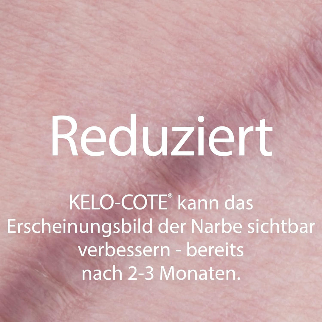 Kelo-cote Advanced Formula Scar Gel 60 g