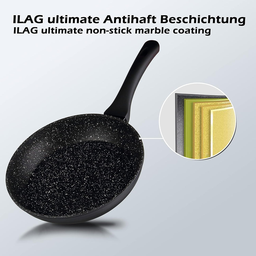 Linnuo Topfset Topf Pfannenset 7tlg - 3 Töpfe mit Glasdeckel & 1 Pfanne - Alu Kochtopf Set Marmor Ke