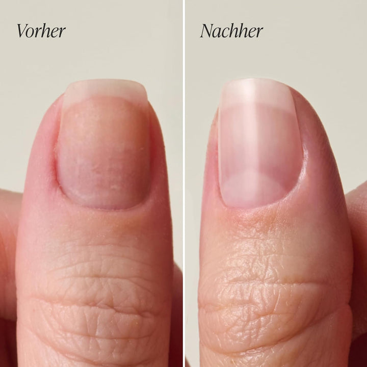 Doonails – Nail Hardener – Nagelhärter für geschwächte, brüchige Nägel – Mit Diamantenstaub für mehr