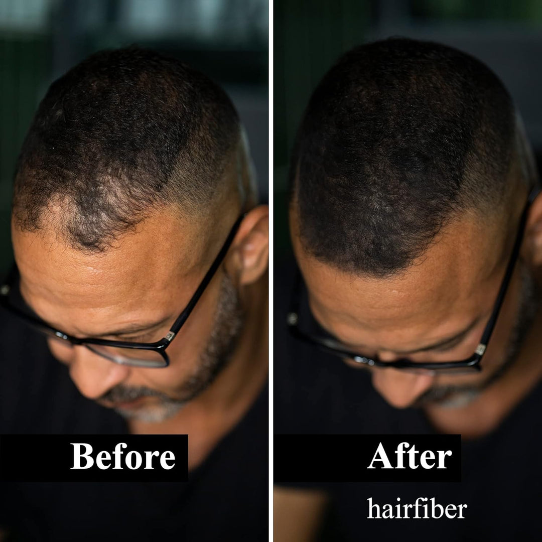 LEON MIGUEL Hair Fiber - Haarverdichtung - Premium Streuhaar/Schütthaar mit Soforteffekt bei Geheimr