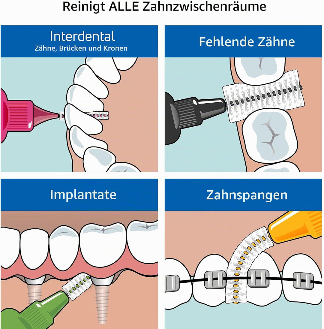 TePe Interdentalbürsten Original GRÜN 0,8 mm, 25 Stück Grün 25 stück (1er Pack), Grün 25 stück (1er