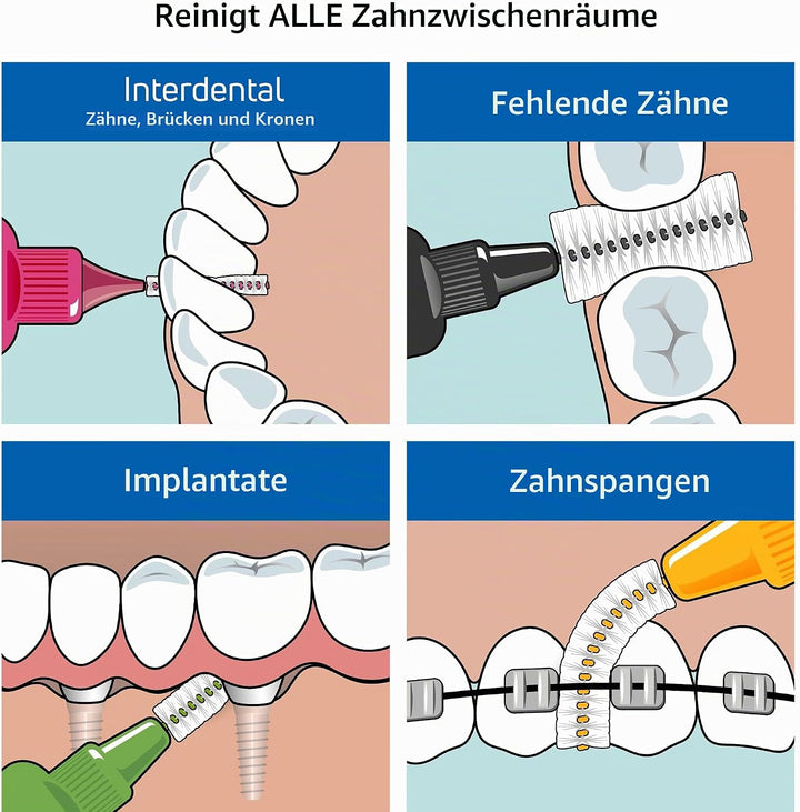 TePe Interdentalbürsten Original GRÜN 0,8 mm, 25 Stück Grün 25 stück (1er Pack), Grün 25 stück (1er