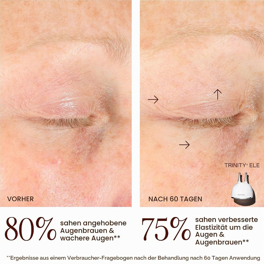 NuFACE TRINITY+ Effective Lip &amp; Eye Attachment Trinity+ Wirksames Lippen- und Augenzubehör, Trinity+