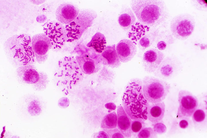 Bresser Mikroskop Dauerpräparate 30 Stück in Kunststoffbox, Lernpräparate aus der Biologie Single, S