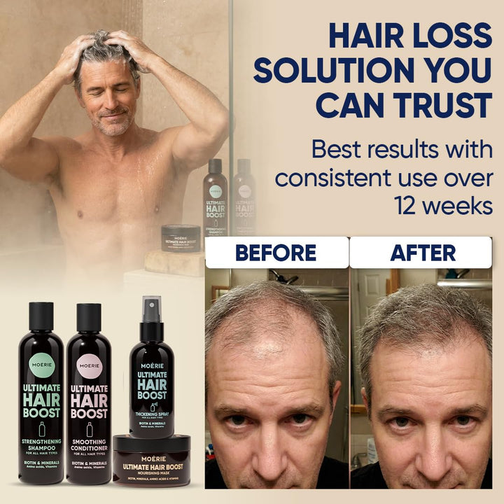 MOERIE Shampoo Set - gegen Haarausfall, Conditioner, Haarwachstum Serum & Haarmaske - natürlich Haar