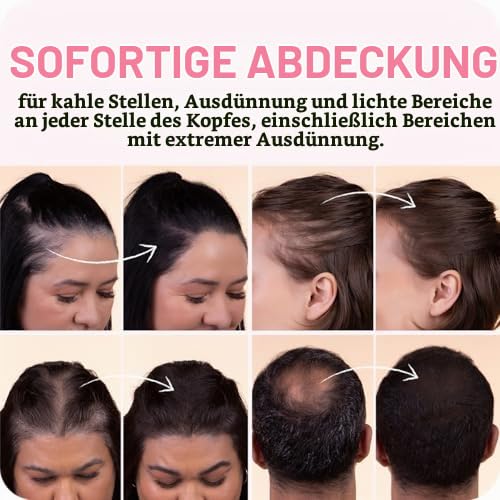 BOLDIFY Ansatzpuder 4g - Haar Concealer zur Haarverdichtung für Frauen und Männer, Grauabdeckung für