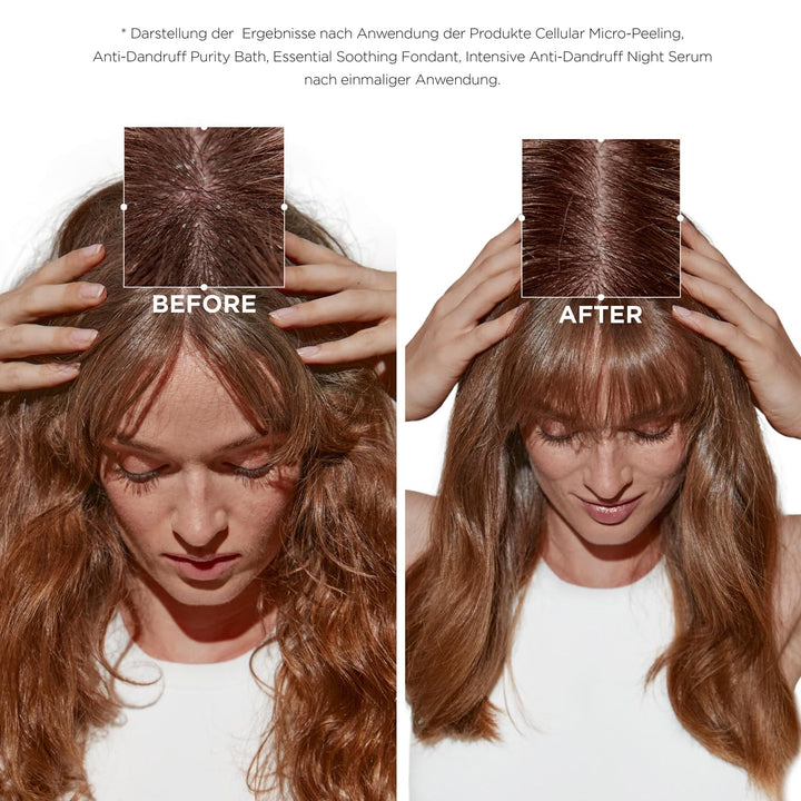 Kérastase, Symbiose, Anti-Schuppen Pflegeroutine mit Peeling, Shampoo, Haarspülung und Haarserum, Fü