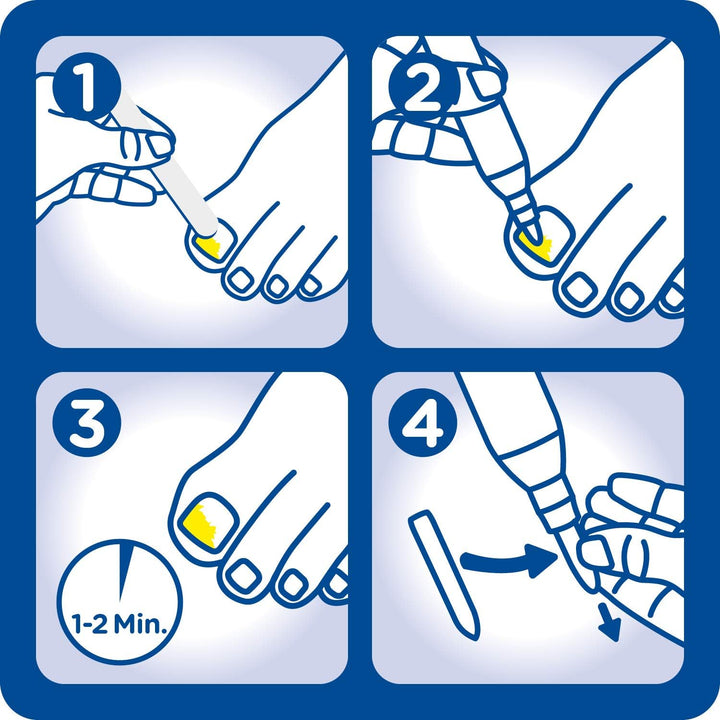 Anti Nagelpilz Stift (4ml) · Burgit · Schnelle Pilzbehandlung · Bei Nagelinfektionen · Verfärbte Ver