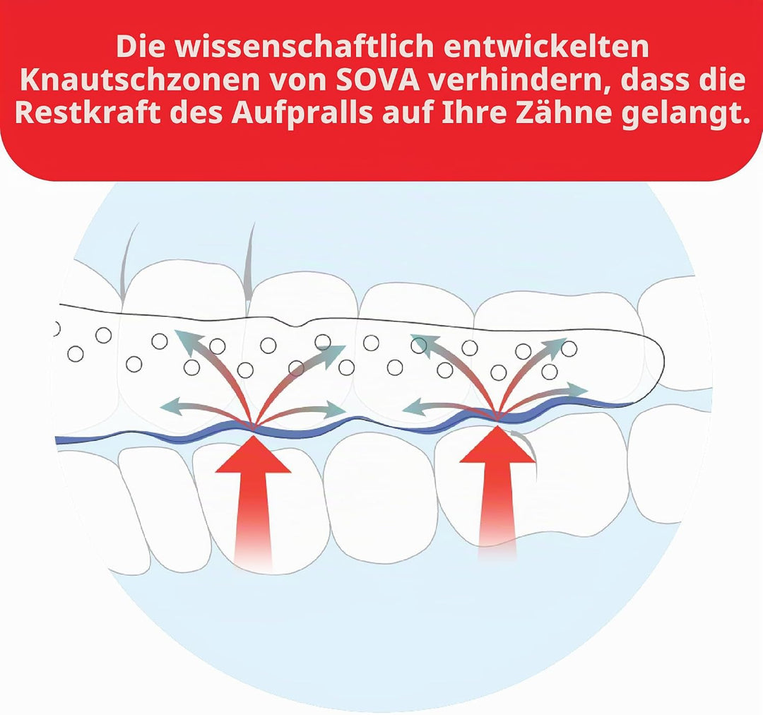 SOVA Max Aufbissschiene - 2,4 mm - Passgenauer Zahnschutz - Schützt Vor Nächtlichem Zähneknirschen u