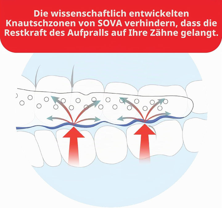 SOVA Max Aufbissschiene - 2,4 mm - Passgenauer Zahnschutz - Schützt Vor Nächtlichem Zähneknirschen u