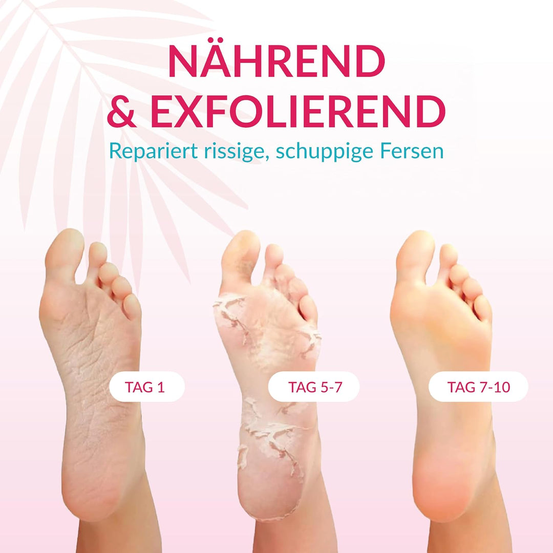 Summer Foot Premium Hornhaut-Entferner - Hornhaut Fussmaske für weiche Füsse - Anti Hornhaut-Socken