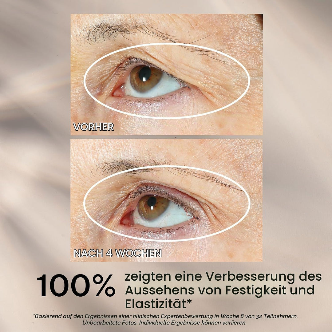 StriVectinTIGHTEN &amp; LIFT 360º tightening eye serum 30 ml, Tighten &amp; Lift