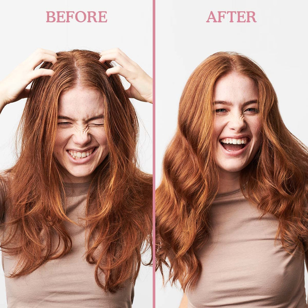 Umberto Giannini Scalp Restore Conditioner 250ml Anti-Schuppen Conditioner, 250 ml, Anti-Schuppen Co