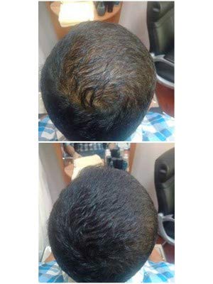 Nanogen Hair Thickening Fibres Dark Brown, 30g dunkelbraun 30g, dunkelbraun 30g