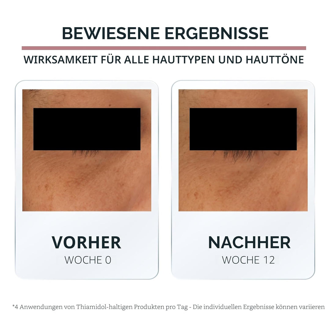 Eucerin Face Antipigment Augencreme 15 ml