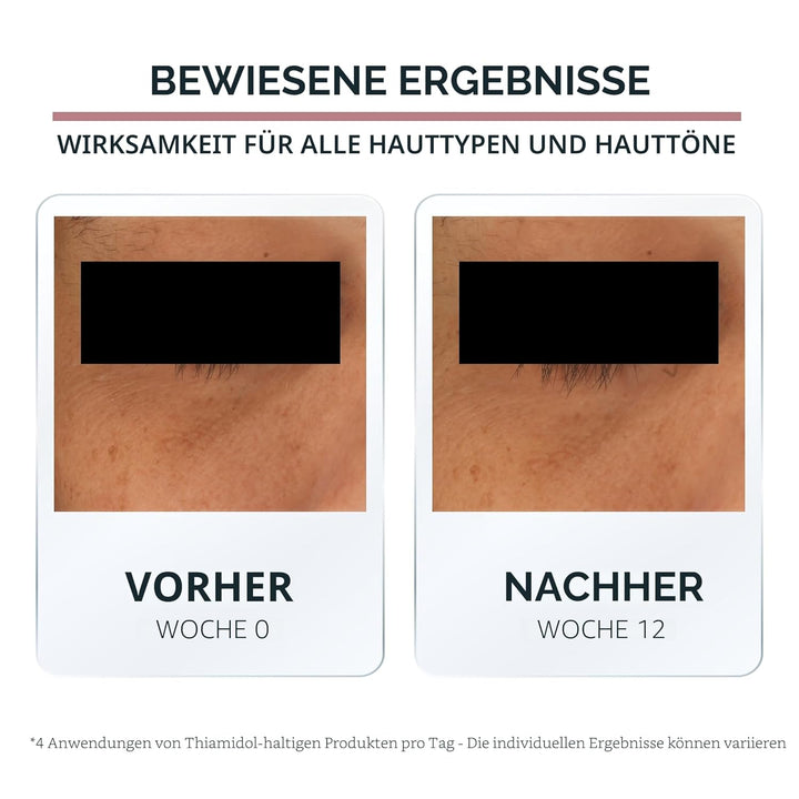 Eucerin Face Antipigment Augencreme 15 ml