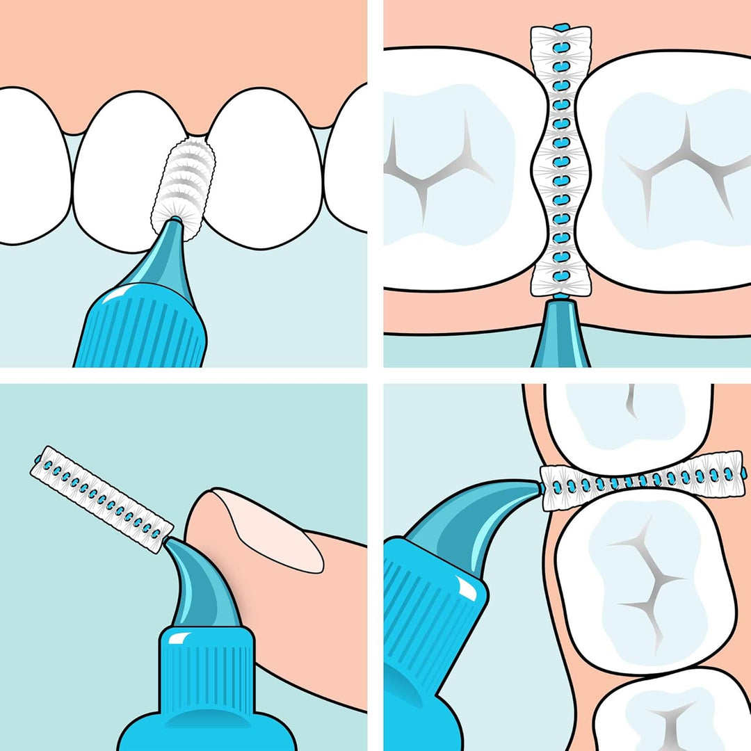 TePe Interdentalbürste, Original, Gelb, 0,7 mm/ISO 4, 20 Stk., Plaque-Entfernung, effiziente Reinigu